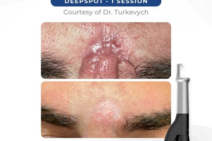 Asclepion Laser Technologies