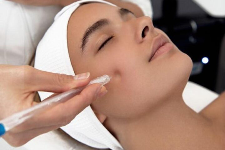 Jetpeel
